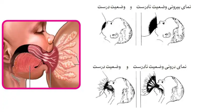 همه چیز درباره تغذیه با شیر مادر 6 وضعیت شیردهی درست